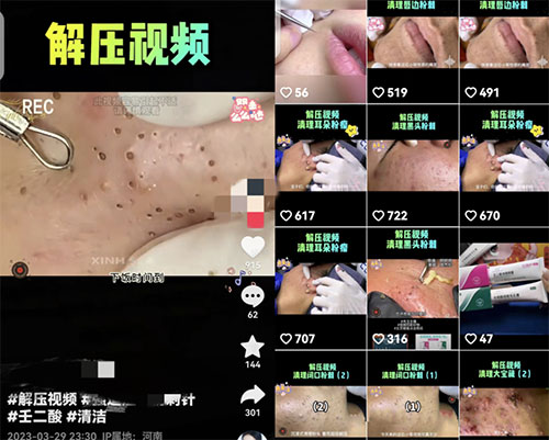 18cc96762e74a64b646d902b3b482244_20240925063116-66f3ae3443230.jpg 解压小视频,涨粉上千就能轻松销量破万